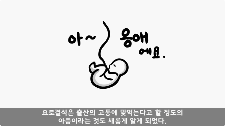 돌맹이를 낳은 일병.jpg_38.jpg