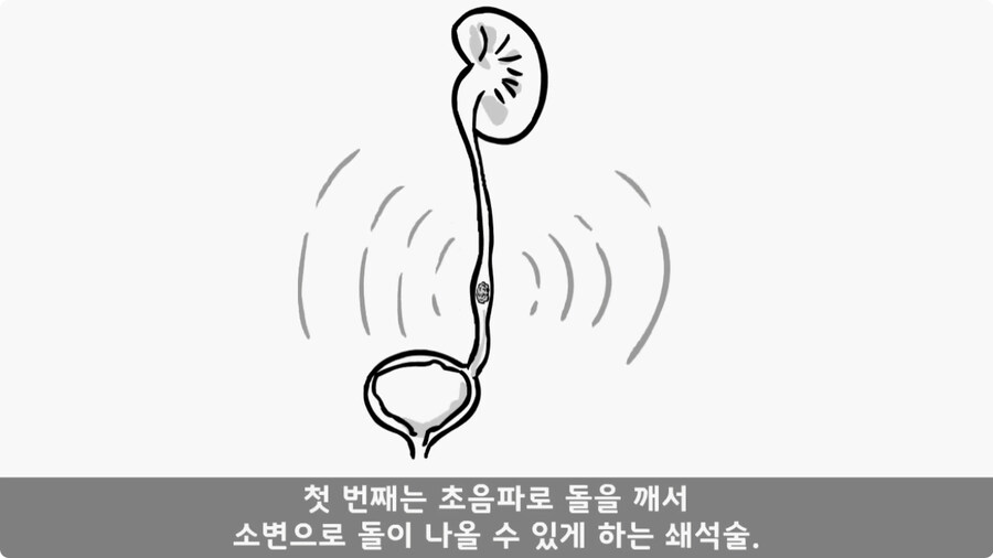 돌맹이를 낳은 일병.jpg_53.jpg