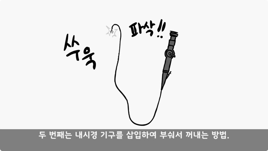 돌맹이를 낳은 일병.jpg_54.jpg