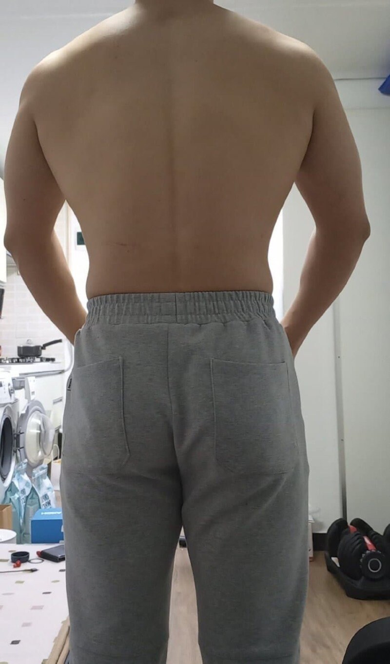 정형외과 의사가 이해하기 힘들었던 환자_2.jpg