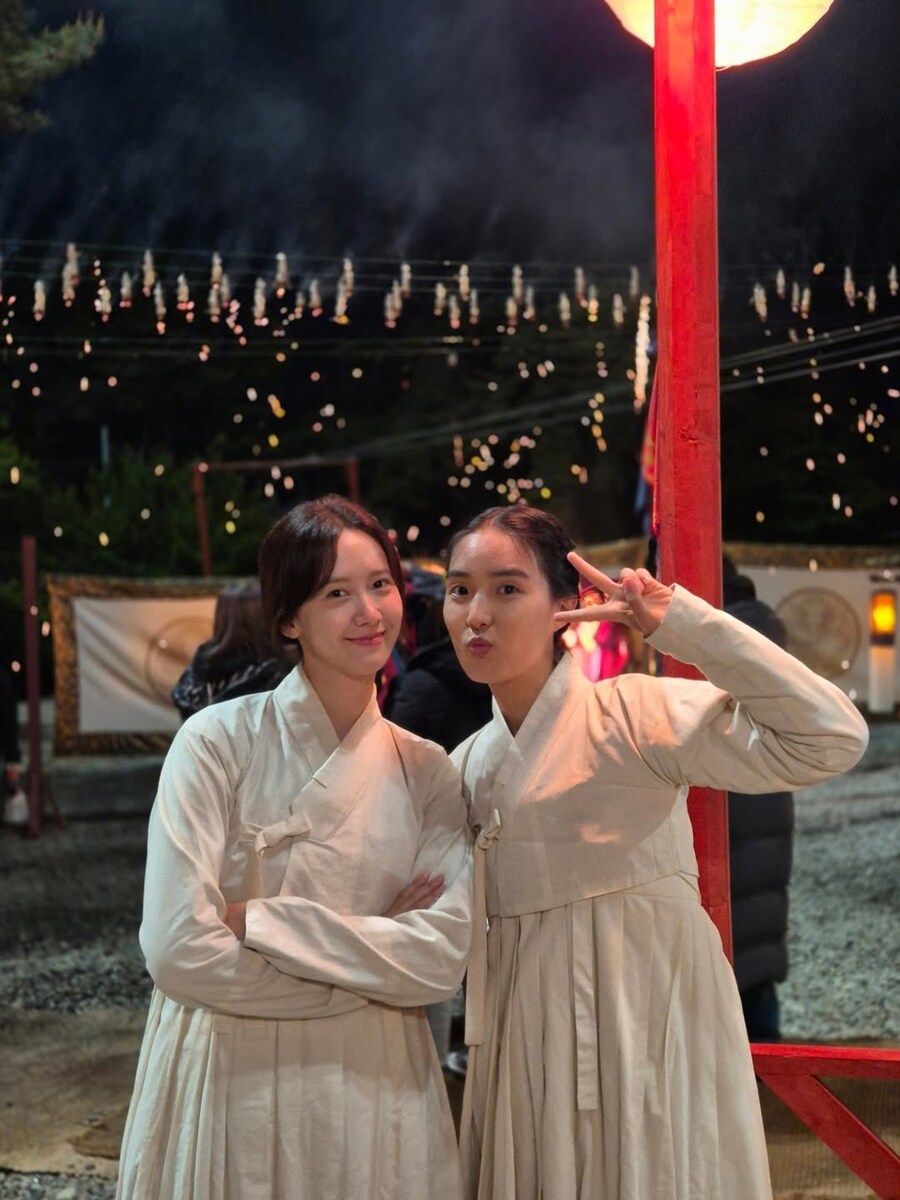 [폭군의셰프] 촬영으로 손이다탄 윤아_2.jpg