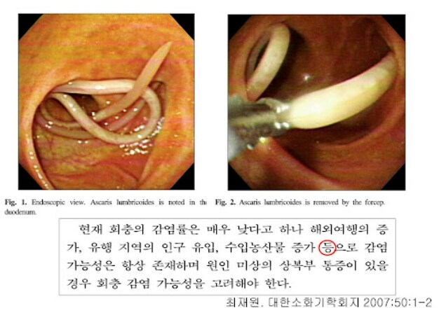 지금도 민물고기회 함부로 먹지말라는 이유_1.png