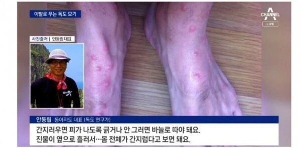 독도에 서식하는 끔찍한 해충_4.jpg