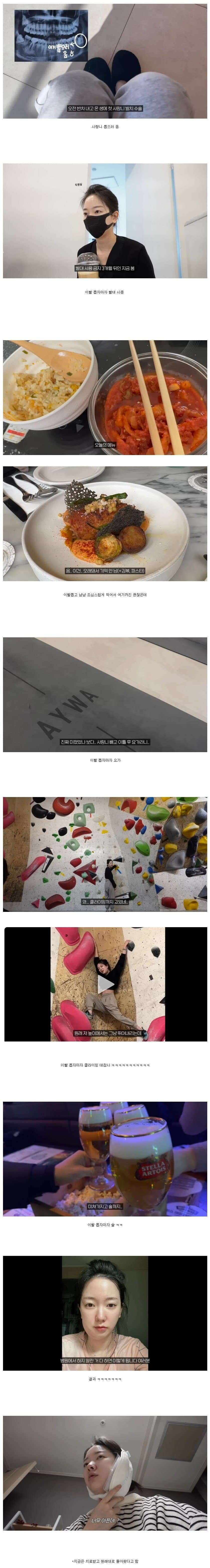 사랑니 뽑고 하지 말란 거 다 한 사람의 최후.jpg_1.jpg
