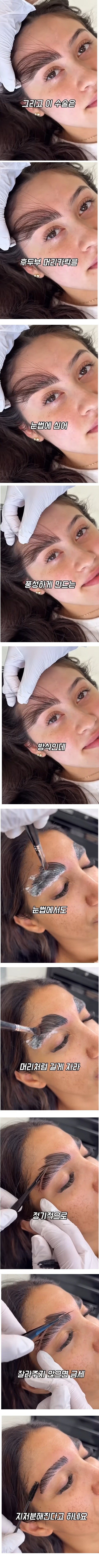 신형 눈썹 성형 수술_1.jpg