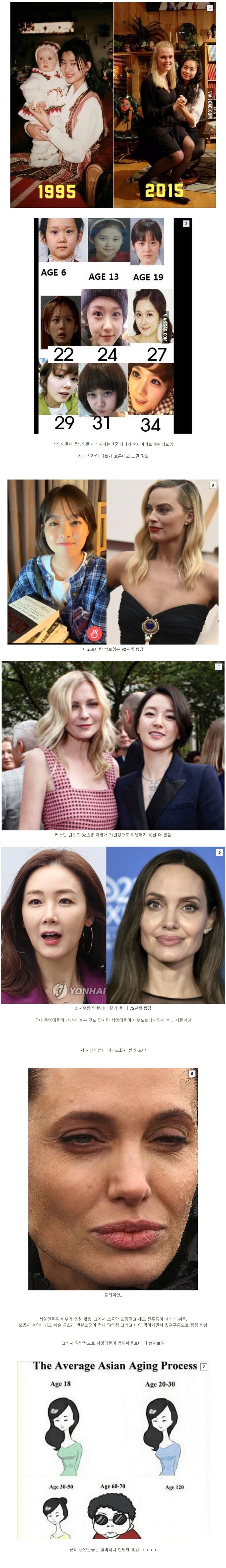 진짜 늙는게 엄청 빠르다는 서양인.jpg_1.jpg