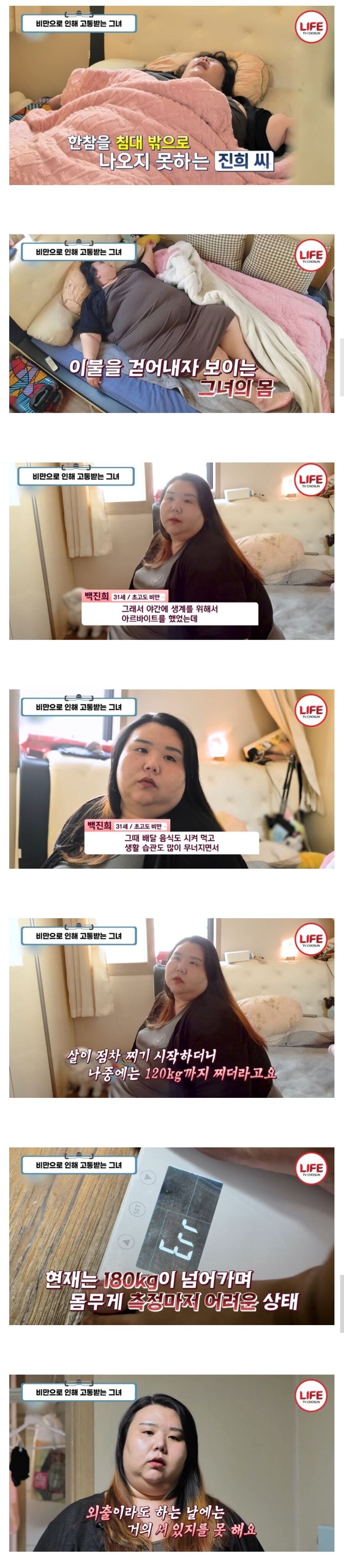 지팡이로 생활하는 31살 초고도비만녀_1.jpg