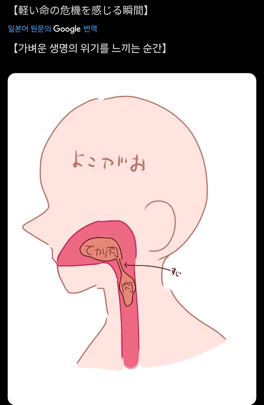 일상속 생명의 위기 느껴보기_1.jpg