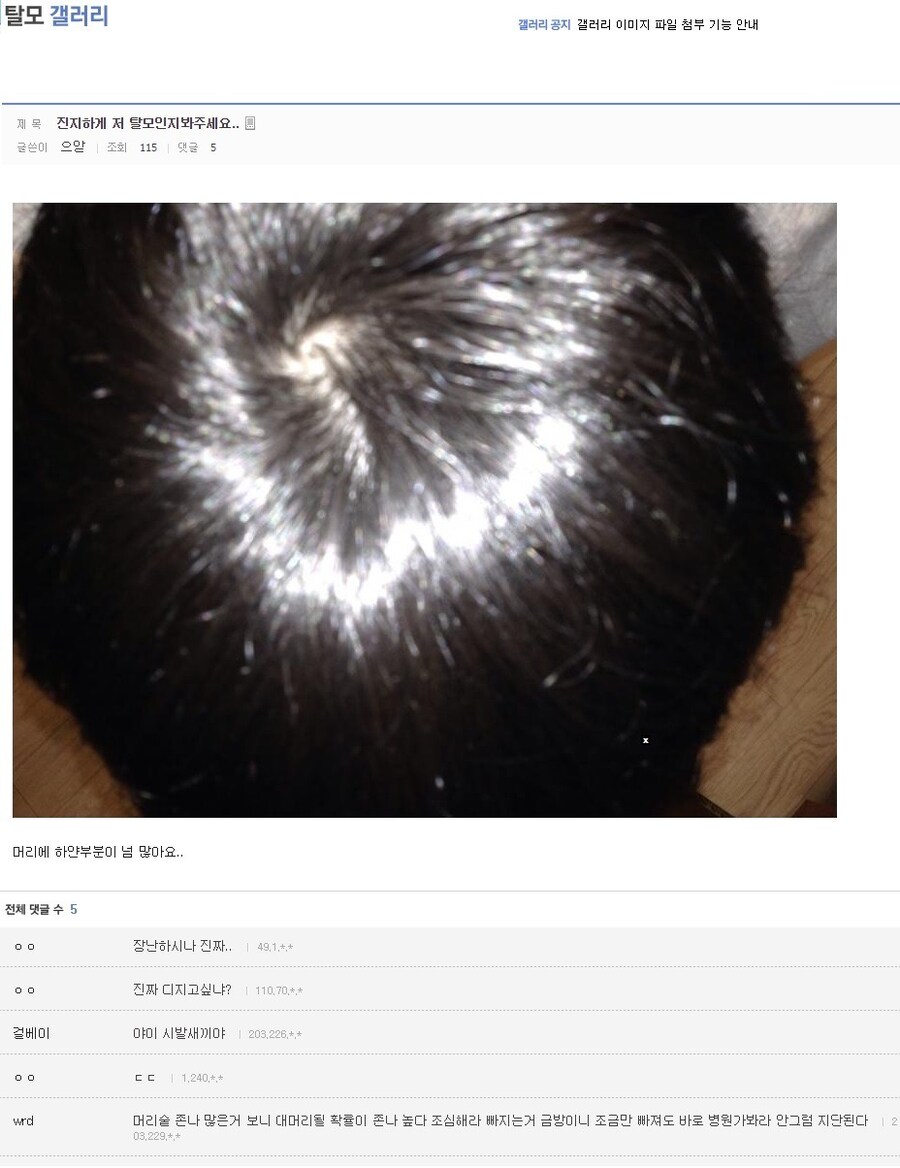??? : 진지하게 저 탈모인지 봐주세요..._1.png