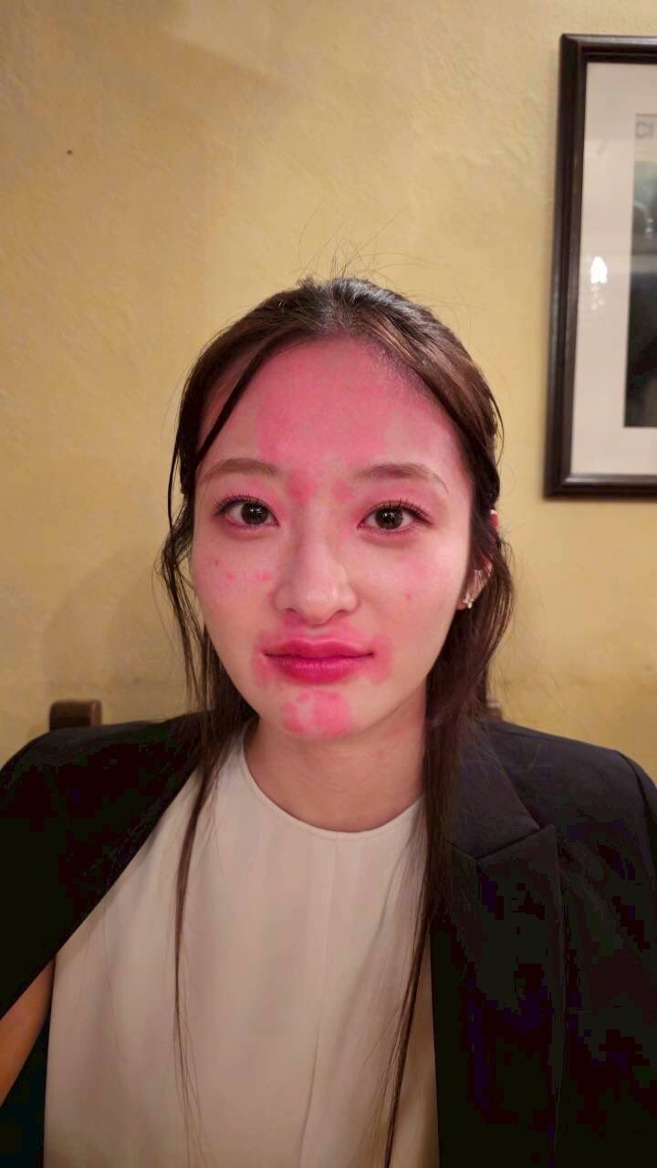 술마시면 얼굴이 빨개지는 여자_3.jpg