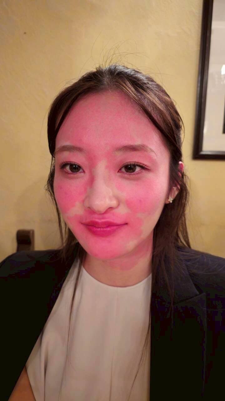 술마시면 얼굴이 빨개지는 여자_5.jpg