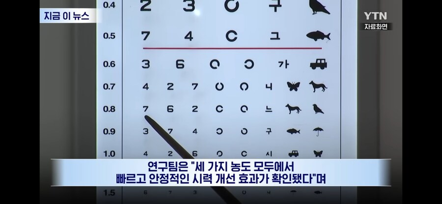 노안 개선 안약 임상 중_4.jpg
