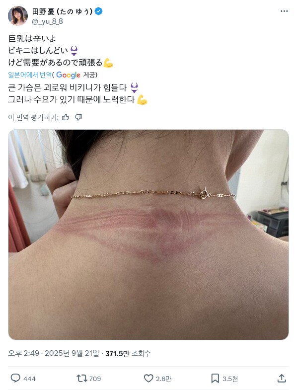 거유가 힘든 이유.X_1.png