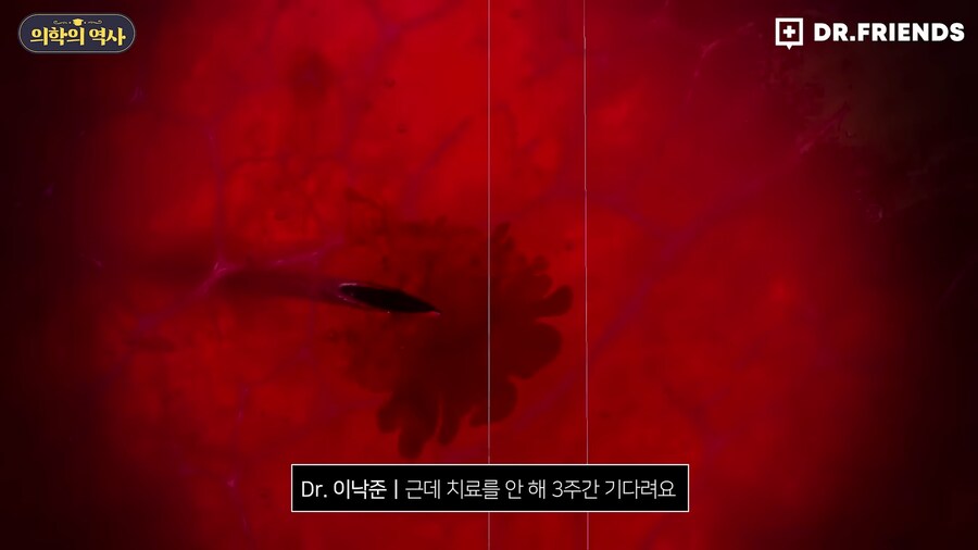 미국에 백신관련 음모론자가 유독 많은 이유_54.png