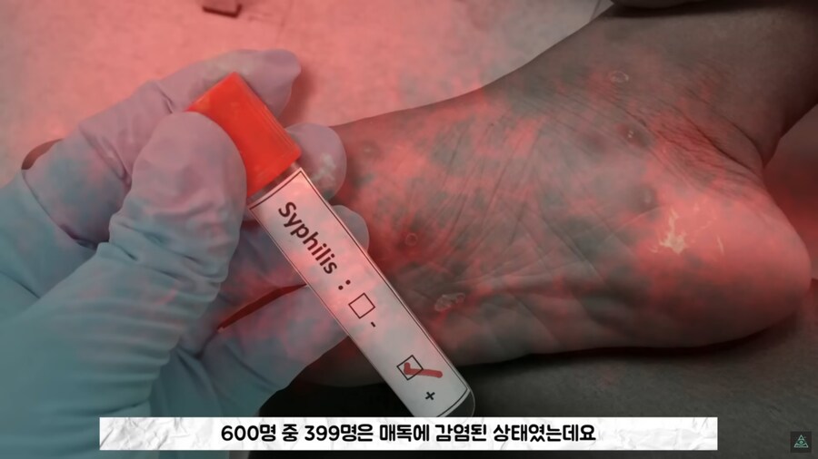 미국에 백신관련 음모론자가 유독 많은 이유_20.png