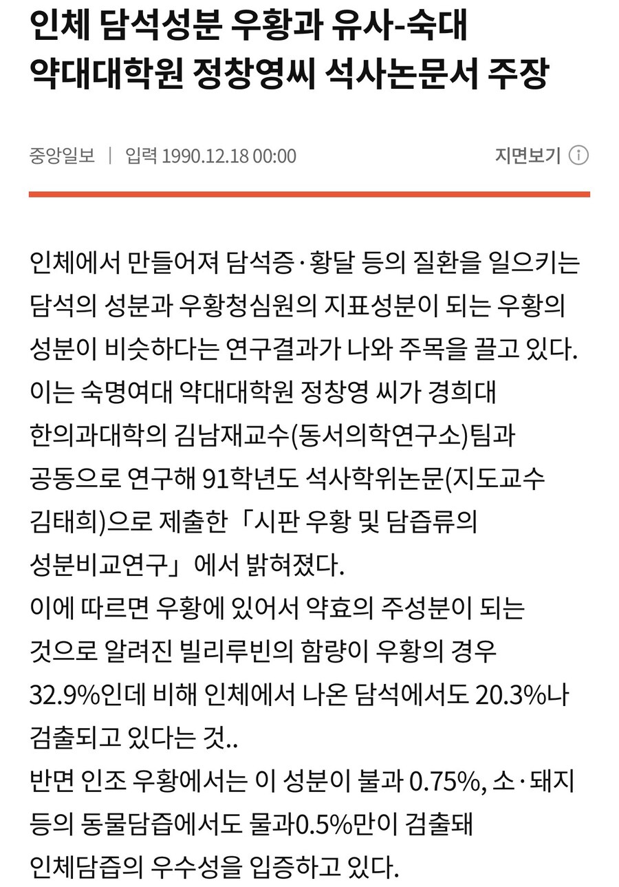 인간 담석이 우황처럼 각광 받지 않는 이유_1.jpg