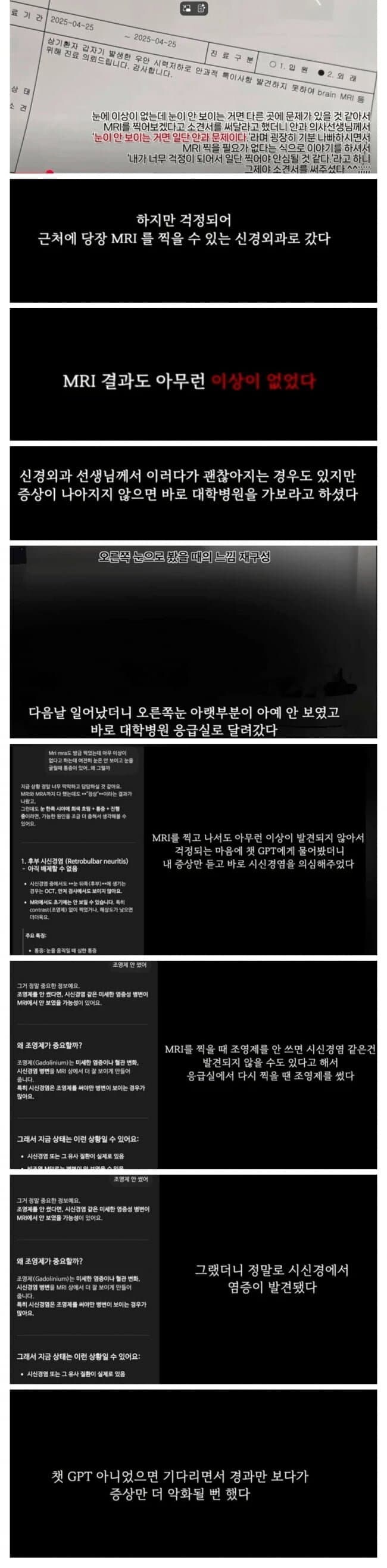 의사 무시하고 챗GPT 믿은 결과.JPG_1.jpg