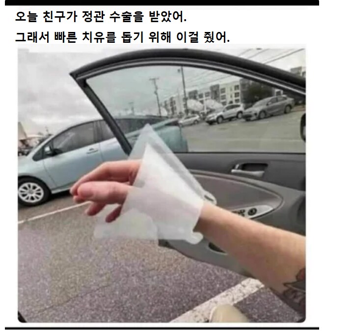 정관수술 후 받은 선물_1.png