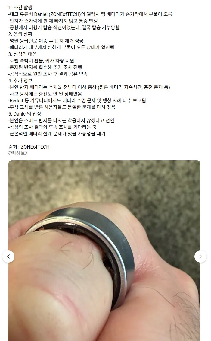 갤럭시링 배터리 부푼거 ㅈㄴ 무섭네_1.png