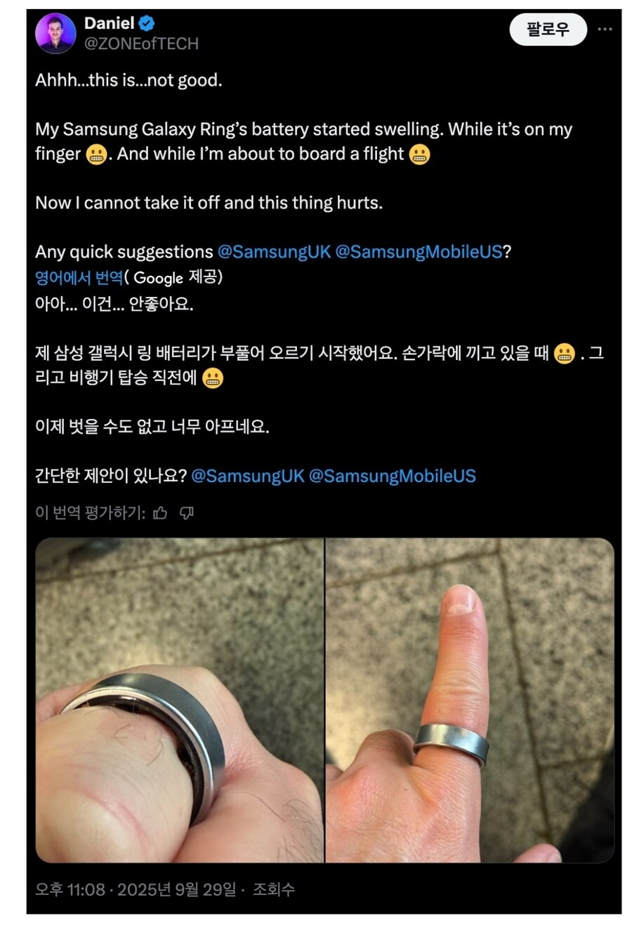 갤럭시링 배터리 부푼거 ㅈㄴ 무섭네_2.png