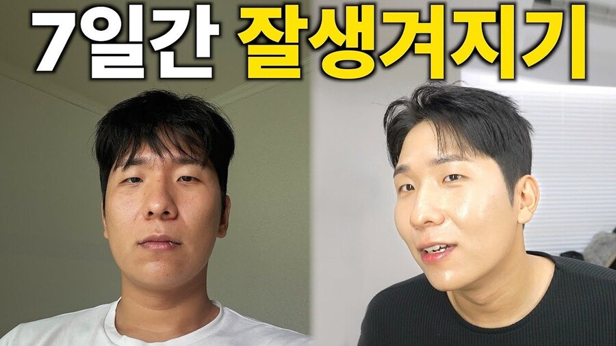 천만원 써서 7일간 잘생겨지기 도전한 유튜버.jpg_1.jpg