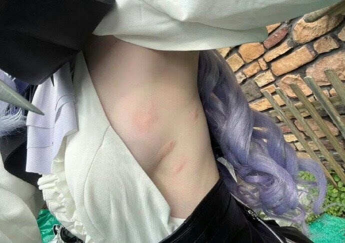 야외에서 코스프레 촬영할 때의 단점_2.jpg