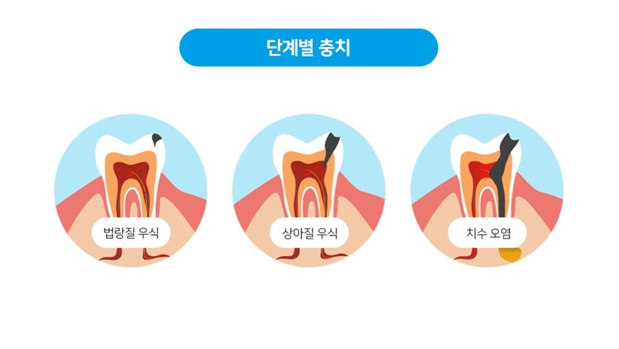 동성끼리 키스하면 위험한 이유_1.jpg