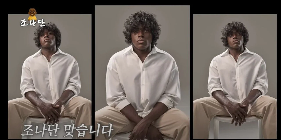 이른 나이에 탈모 진단을 받은 조나단_3.webp