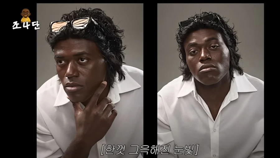 이른 나이에 탈모 진단을 받은 조나단_4.webp