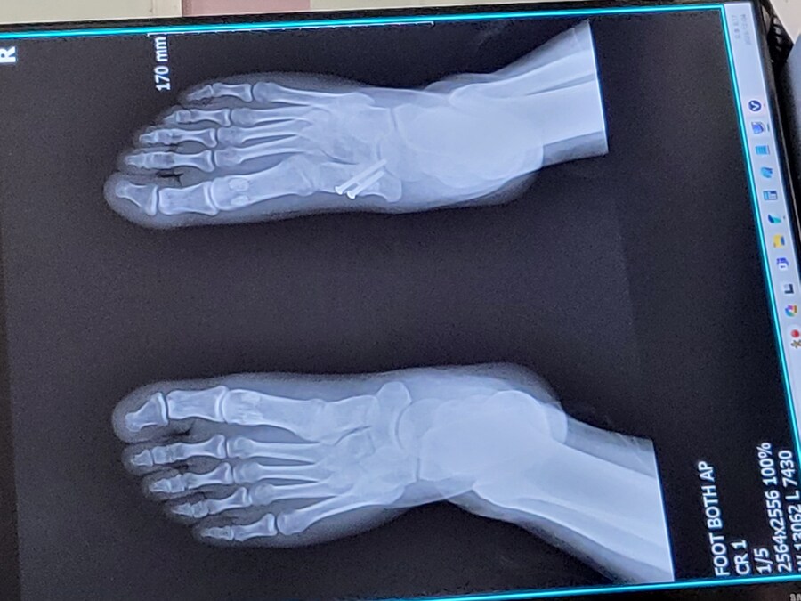 정형외과는 돌팔이여도 된다고?_1.jpg