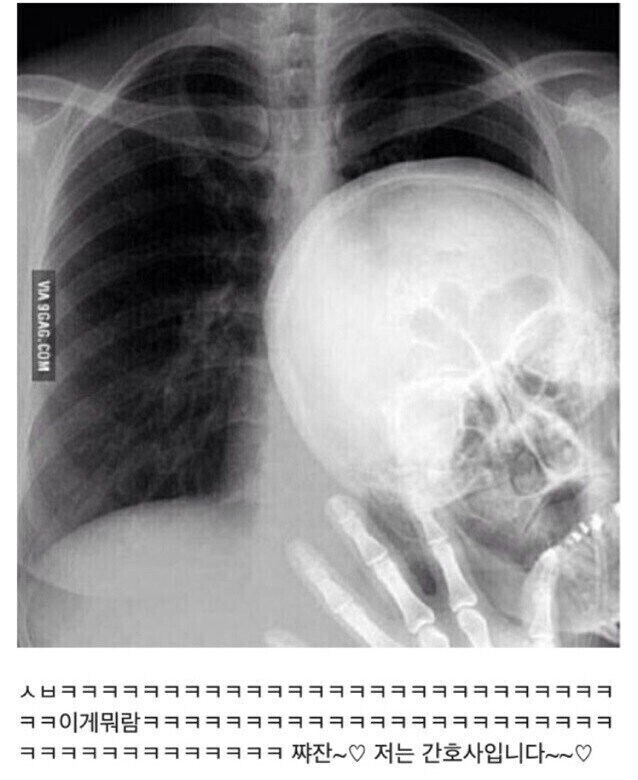 투샷 찍으면 어색한거_1.jpg