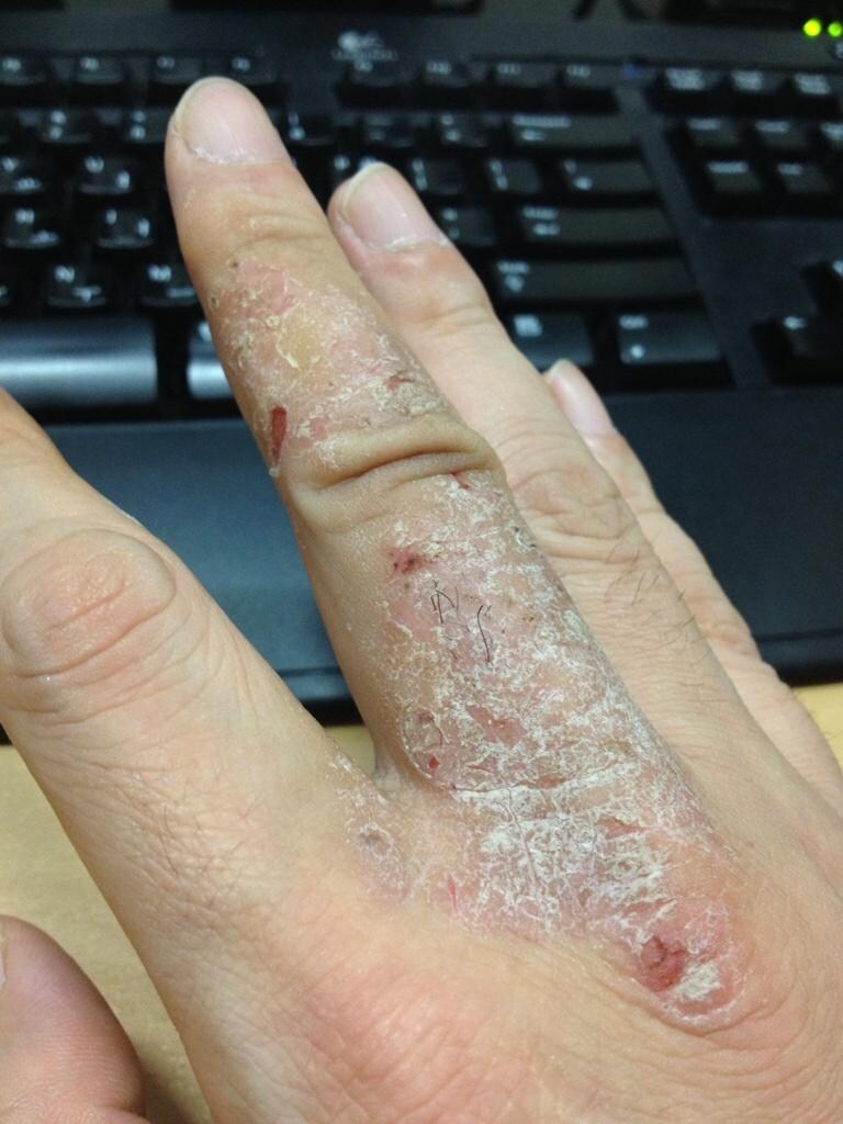 유독한 독성 물질 불산의 재료_1.jpg