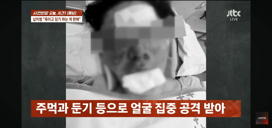 사건반장에 나온 수탉 피해사진_2.webp