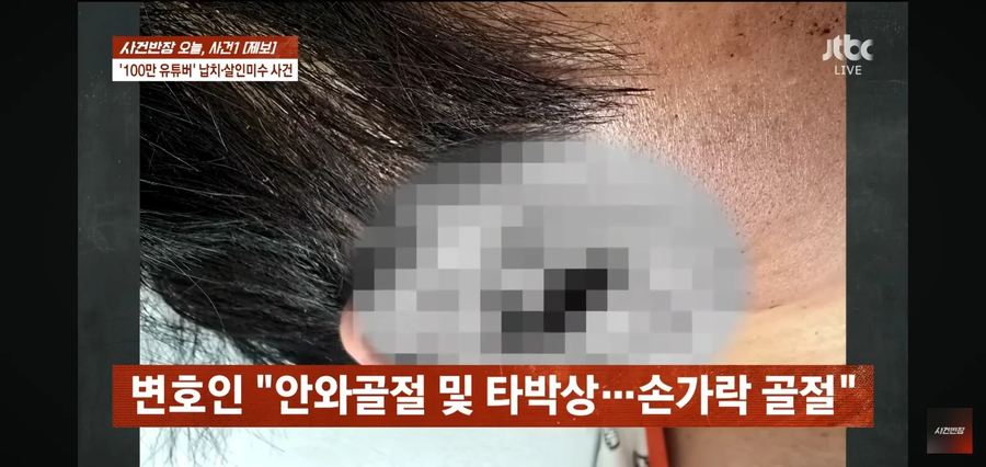 사건반장에 나온 수탉 피해사진_3.webp