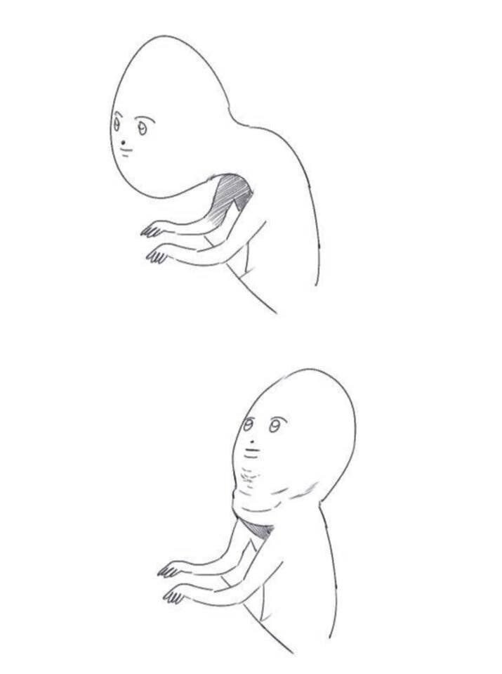 ) 거북목 특징_2.jpeg