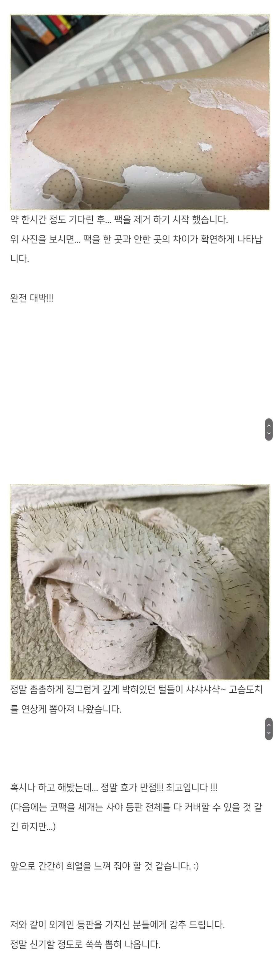 등 잔털 제거 후기.jpg_3.webp