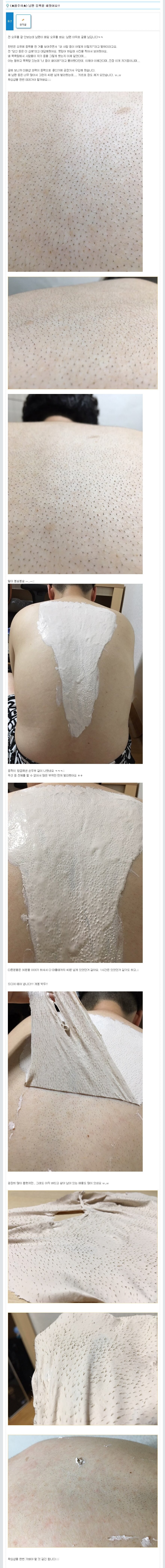 등 잔털 제거 후기.jpg_7.jpg