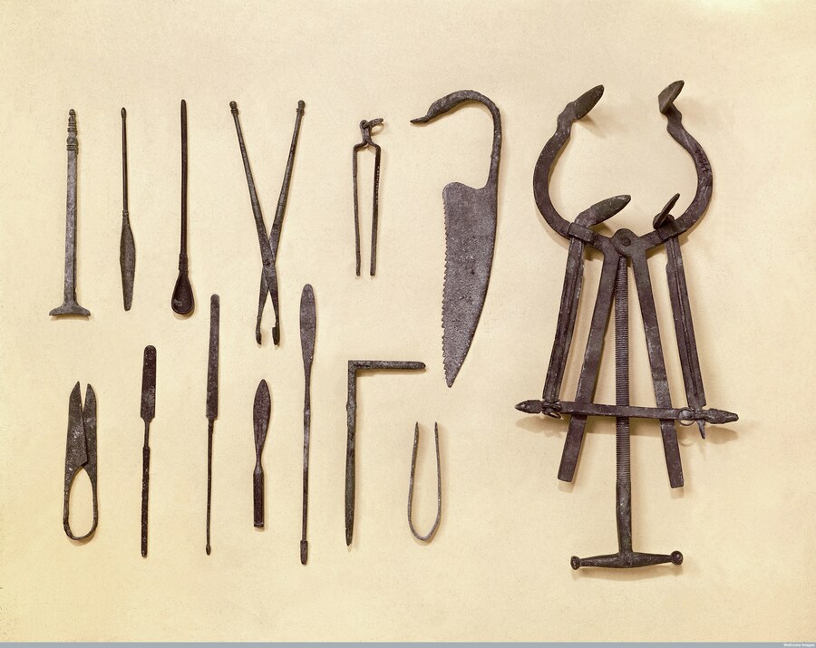 영화 프랑켄슈타인 속 신나는 근대 의학_2.png