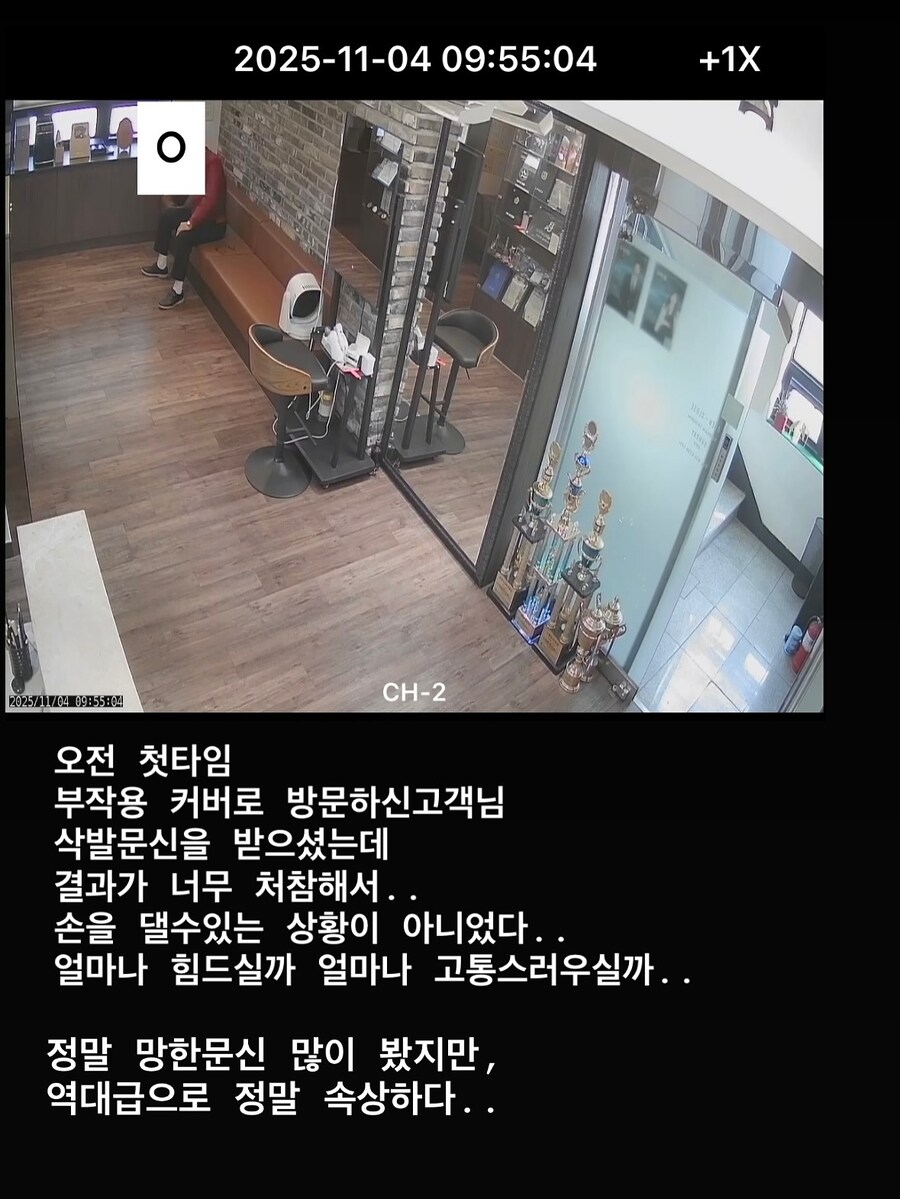 두피문신 시술 전문가가 경악한 망한 두피문신_1.jpg