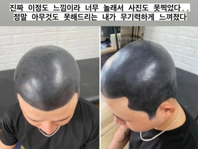 역대급으로 망한 두피 문신.jpg_3.jpg