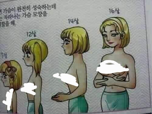 여성의 나이대별 유방 발달_1.jpg