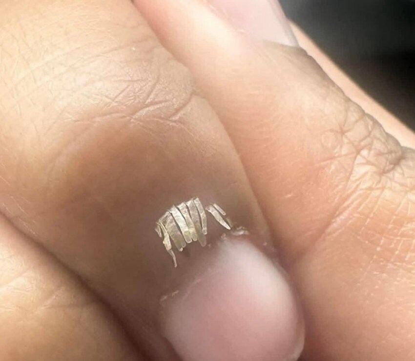 보면 손톱이 간질간질 해지는거_1.jpg