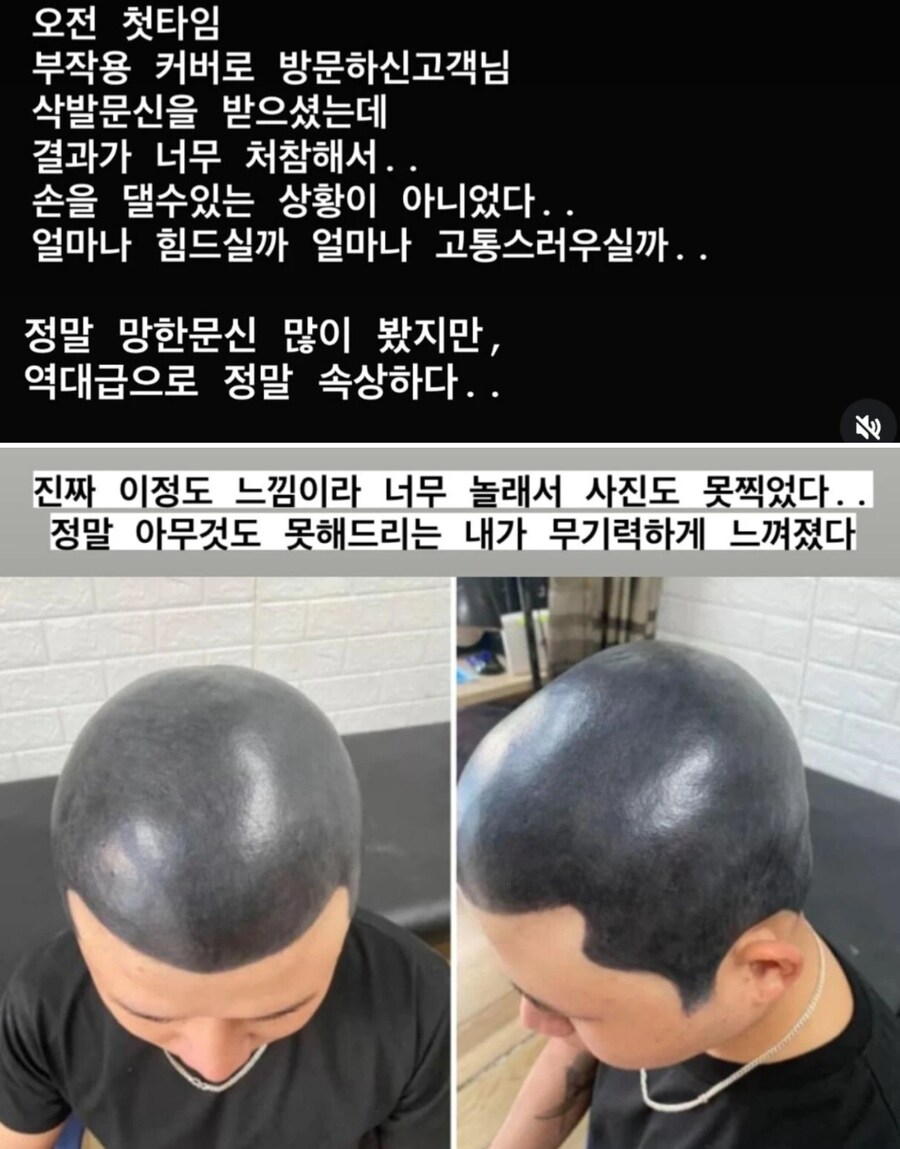 문신 전문가도 포기하고 손을 못쓴 문신망한 손님_1.png