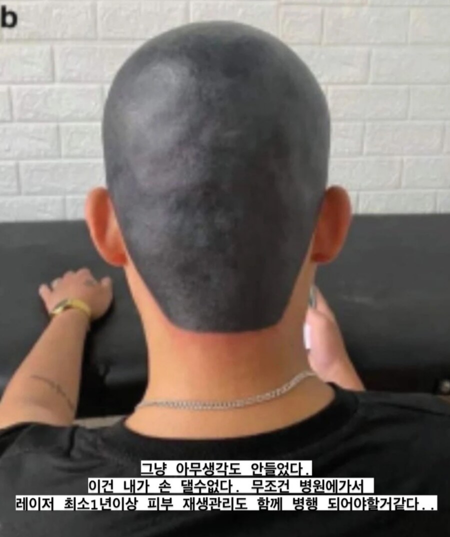 문신 전문가도 포기하고 손을 못쓴 문신망한 손님_2.png