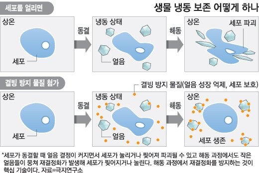 대체 장기 빼간다고 상반신만 잘라간다는건 무슨 멍청이냐_1.jpg