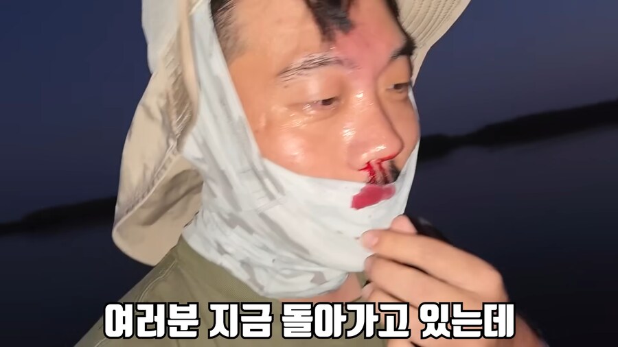 유튜브) 미국에서 폭행 당하고 코피흘리는 유튜버(피 약혐)_2.png