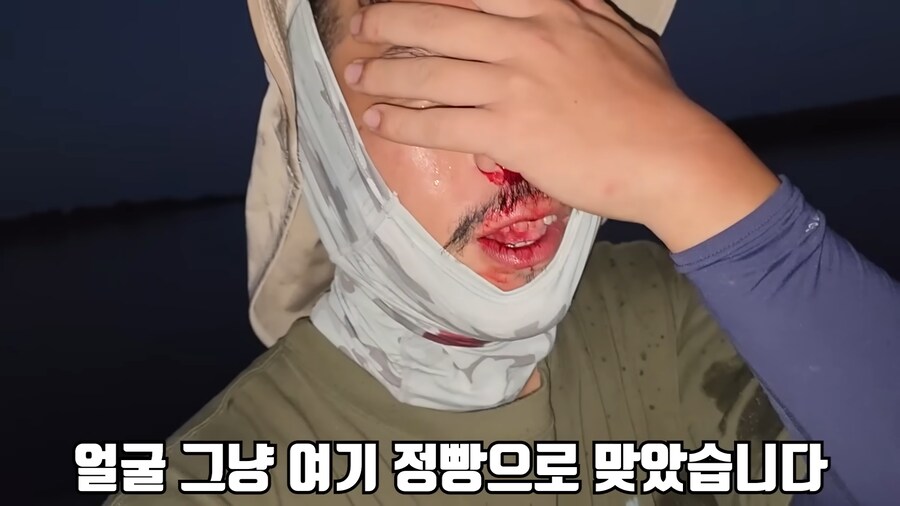 유튜브) 미국에서 폭행 당하고 코피흘리는 유튜버(피 약혐)_5.png