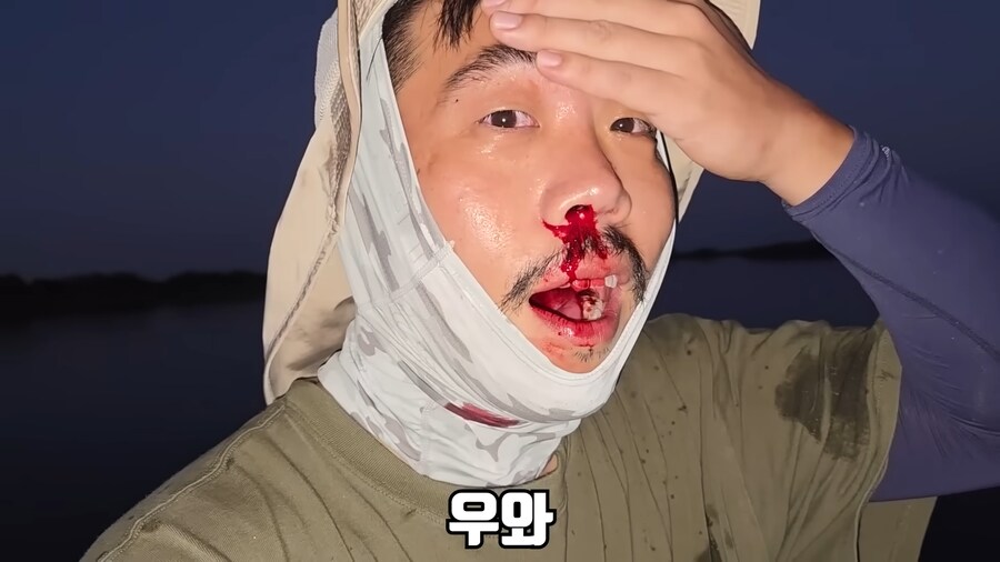 유튜브) 미국에서 폭행 당하고 코피흘리는 유튜버(피 약혐)_6.png