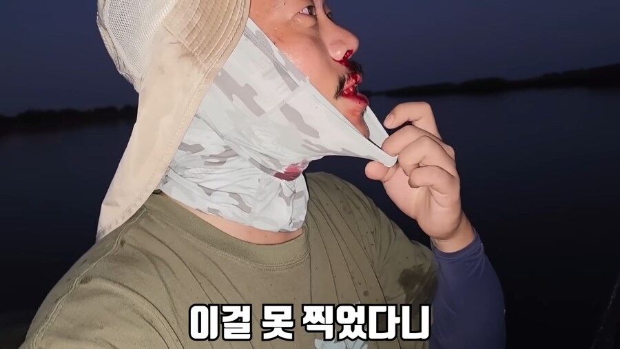 유튜브) 미국에서 폭행 당하고 코피흘리는 유튜버(피 약혐)_7.png