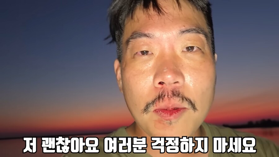 유튜브) 미국에서 폭행 당하고 코피흘리는 유튜버(피 약혐)_14.png